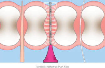 interdental brush